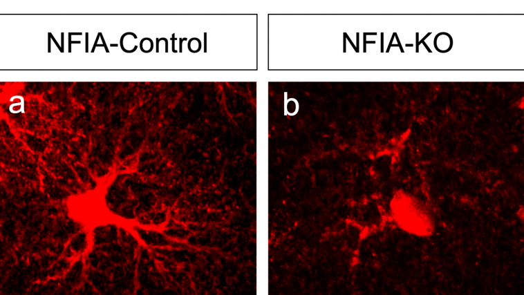 astrocyte_NFIA-Ctrl-KO_crop-cropped-768x482